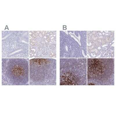 Immunohistochemistry-Paraffin: CD21 Antibody [NBP2-38684]