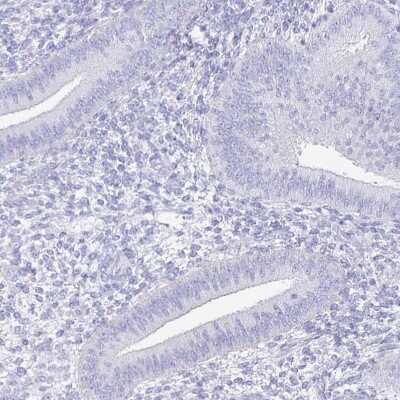 Immunohistochemistry-Paraffin: CD21 Antibody [NBP2-38684]