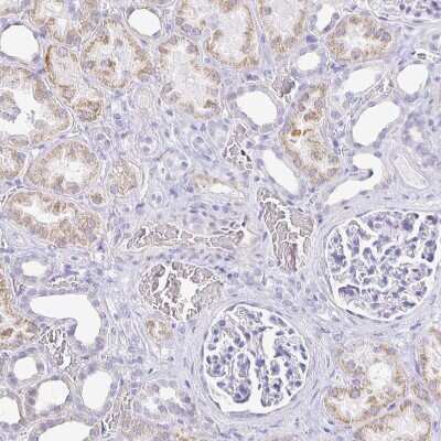 Immunohistochemistry-Paraffin: CD21 Antibody [NBP2-38684]