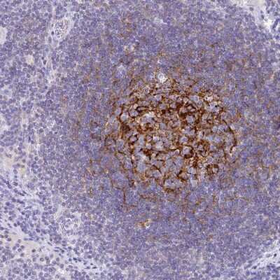 Immunohistochemistry-Paraffin: CD21 Antibody [NBP2-38684]