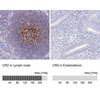 Immunohistochemistry-Paraffin: CD21 Antibody [NBP2-38684]