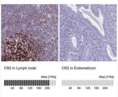 Immunohistochemistry-Paraffin: CD21 Antibody [NBP2-38895]