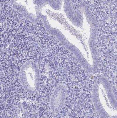 Immunohistochemistry-Paraffin: CD21 Antibody [NBP2-38895]