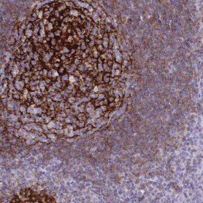 Immunohistochemistry-Paraffin: CD21 Antibody [NBP2-38895]