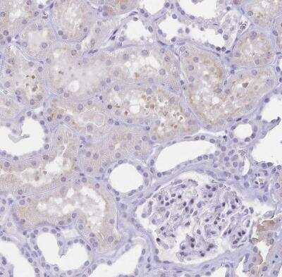 Immunohistochemistry-Paraffin: CD21 Antibody [NBP2-38895]