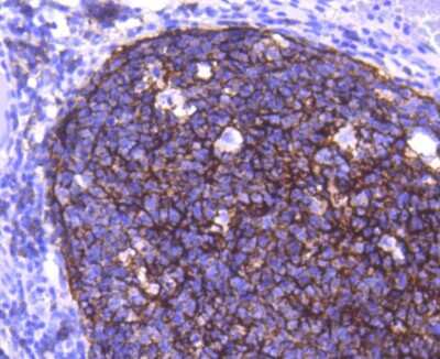Immunohistochemistry-Paraffin: CD21 Antibody (SC0681) [NBP2-67605]