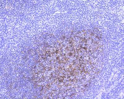 Immunohistochemistry-Paraffin: CD21 Antibody (SC0681) [NBP2-67605]