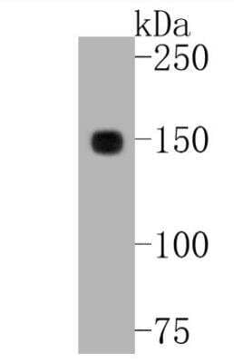 Western Blot: CD21 Antibody (SC0681) [NBP2-67605]