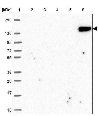Western Blot: CD21 Antibody [NBP2-38895]
