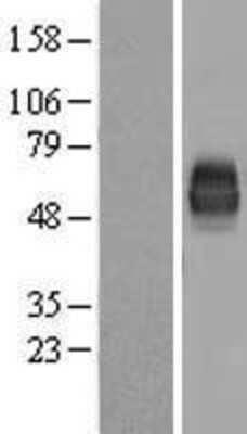 Western Blot: DNAM-1/CD226 Overexpression Lysate [NBL1-08922]