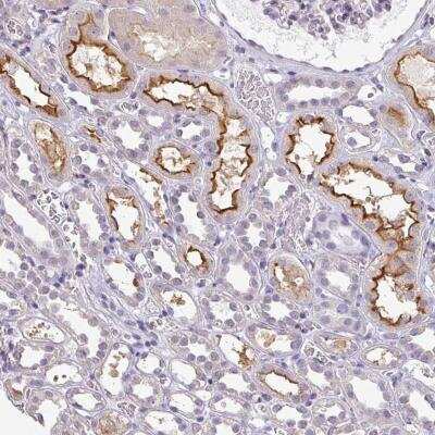 Immunohistochemistry-Paraffin: CD229/SLAMF3/Lymphocyte Antigen 9 Antibody [NBP2-30776]
