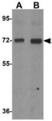 Western Blot: CD229/SLAMF3/Lymphocyte Antigen 9 AntibodyBSA Free [NBP1-76557]