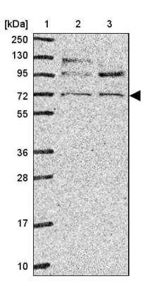 Western Blot: CD229/SLAMF3/Lymphocyte Antigen 9 Antibody [NBP2-30776]