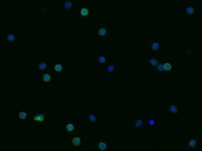 Immunocytochemistry/ Immunofluorescence: CD23/Fc epsilon RII Antibody (007) [NBP2-90682]