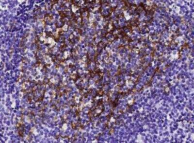 Immunohistochemistry-Paraffin: CD23/Fc epsilon RII Antibody (160) [NBP2-89366]