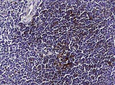 Immunohistochemistry-Paraffin: CD23/Fc epsilon RII Antibody (160) [NBP2-89366]