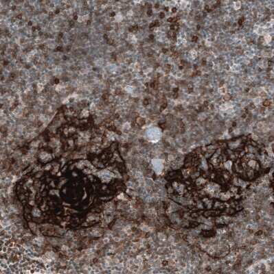 Immunohistochemistry-Paraffin: CD23/Fc epsilon RII Antibody (CL12435) [NBP3-15134]