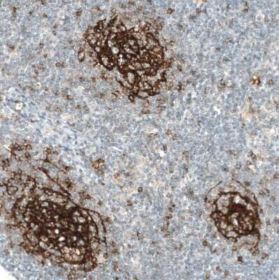 Immunohistochemistry-Paraffin: CD23/Fc epsilon RII Antibody (CL12435) [NBP3-15134]