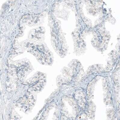 Immunohistochemistry-Paraffin: CD23/Fc epsilon RII Antibody (CL12435) [NBP3-15134]