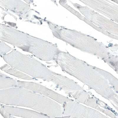 Immunohistochemistry-Paraffin: CD23/Fc epsilon RII Antibody (CL12435) [NBP3-15134]