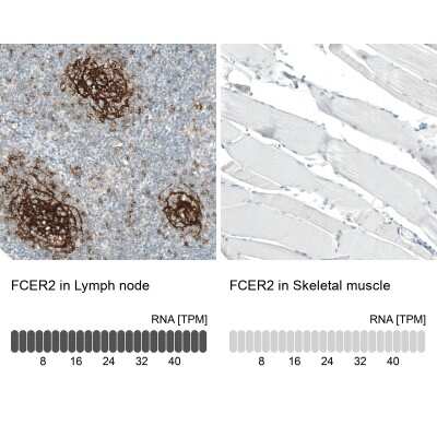 Immunohistochemistry-Paraffin: CD23/Fc epsilon RII Antibody (CL12435) [NBP3-15134]