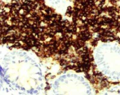 Immunohistochemistry-Paraffin: CD23/Fc epsilon RII Antibody (EBVCS2) [NBP1-43433]