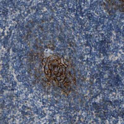 Immunohistochemistry-Paraffin: CD23/Fc epsilon RII Antibody [NBP1-85776]