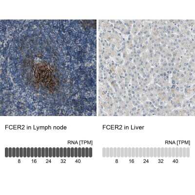 Immunohistochemistry-Paraffin: CD23/Fc epsilon RII Antibody [NBP1-85776]