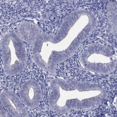 Immunohistochemistry-Paraffin: CD23/Fc epsilon RII Antibody [NBP3-16985]