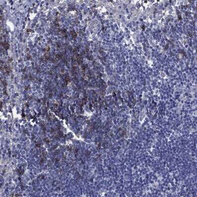 Immunohistochemistry-Paraffin: CD23/Fc epsilon RII Antibody [NBP3-16985]