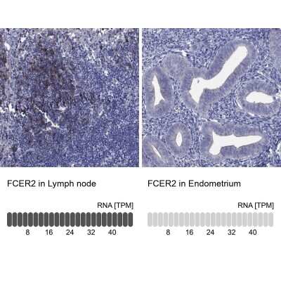 Immunohistochemistry-Paraffin: CD23/Fc epsilon RII Antibody [NBP3-16985]