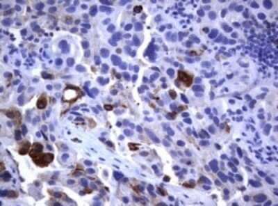 Immunohistochemistry: CD23/Fc epsilon RII Antibody (OTI2B6) - Azide and BSA Free [NBP2-70701]