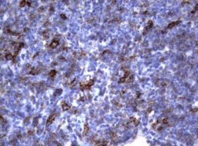 Immunohistochemistry: CD23/Fc epsilon RII Antibody (OTI2B6) - Azide and BSA Free [NBP2-70701]