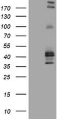 Western Blot: CD23/Fc epsilon RII Antibody (OTI2B6)Azide and BSA Free [NBP2-70701]