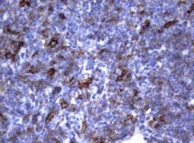 Immunohistochemistry: CD23/Fc epsilon RII Antibody (OTI2B6) [NBP2-45624]