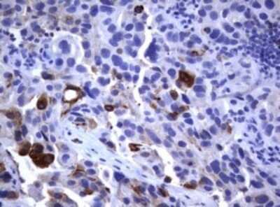 Immunohistochemistry: CD23/Fc epsilon RII Antibody (OTI2B6) [NBP2-45624]
