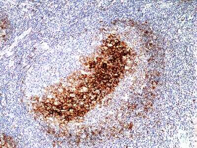 Immunohistochemistry-Paraffin: CD23/Fc epsilon RII Antibody (RM406) [NBP2-89088]