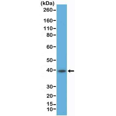 Western Blot: CD23/Fc epsilon RII Antibody (RM406) [NBP2-89088]