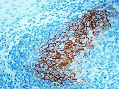 Immunohistochemistry-Paraffin: CD23/Fc epsilon RII Antibody (SP23) [NB120-16702]