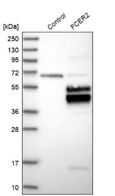 Western Blot: CD23/Fc epsilon RII Antibody [NBP1-85776]