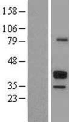 Western Blot: CD23/Fc epsilon RII Overexpression Lysate [NBL1-10652]