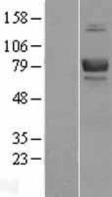 Western Blot: BCAM/CD239 Overexpression Lysate [NBL1-07931]