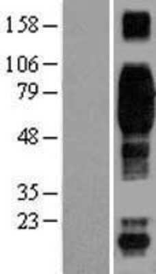 Western Blot: 2B4/CD244/SLAMF4 Overexpression Lysate [NBL1-08924]