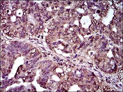 Immunohistochemistry-Paraffin: CD25/IL-2R alpha Antibody (1B5D12) - BSA Free [NBP2-37349]