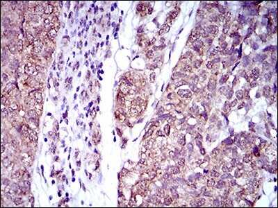 Immunohistochemistry-Paraffin: CD25/IL-2R alpha Antibody (1B5D12) - BSA Free [NBP2-37349]
