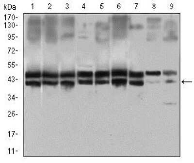 Western Blot: CD25/IL-2R alpha Antibody (1B5D12)BSA Free [NBP2-37349]