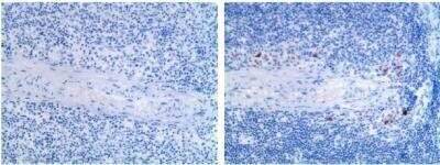 Immunohistochemistry-Paraffin: CD25/IL-2R alpha Antibody (AP-MAB0710) - Azide and BSA Free [NB110-97867]