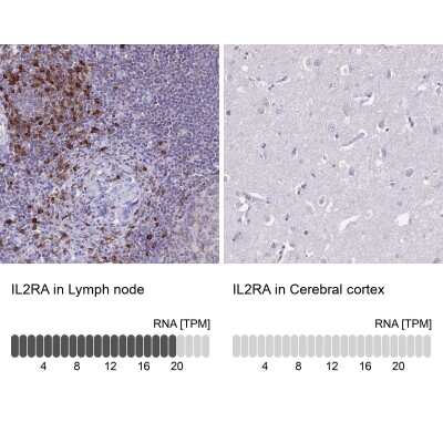 Immunohistochemistry-Paraffin: CD25/IL-2R alpha Antibody [NBP2-38730]