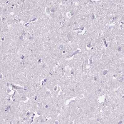 Immunohistochemistry-Paraffin: CD25/IL-2R alpha Antibody [NBP2-38730]