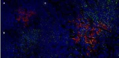 Immunocytochemistry/ Immunofluorescence: CD25/IL-2R alpha Antibody (OX-39) - BSA Free [NB100-64761]